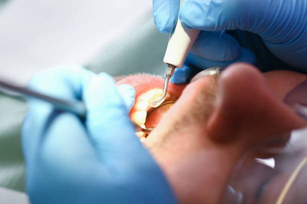 Best Emergency Denture Repair in East Lansing, MI