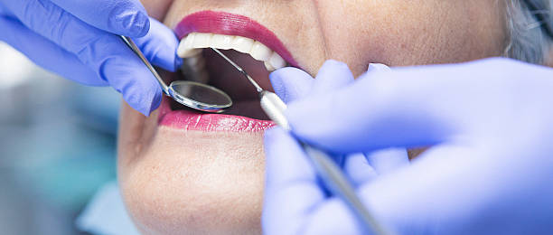 Best Dental Abscess Treatment in East Lansing, MI